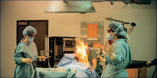Picture of Surgical Fire